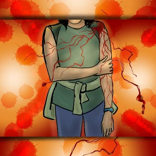 Digital drawing. At center, figure seen from chin to mid-thigh, wearing a top with no sleeves, a shirt or blazer tied around the waist, and a watch around the left wrist. The ends of the figure’s short hair dangle just below the chin. The right hand grips the left at the elbow. The left arm dangles. Rivulets of blood trickle from a wound on the left shoulder. They trickle down the arm, but also float across the body and out from the arm, condensing into larger blobs. Behind the figure is a glowing background with spatters bursting out from the center. Watermark of “Storyfeather” along figure’s right hip.