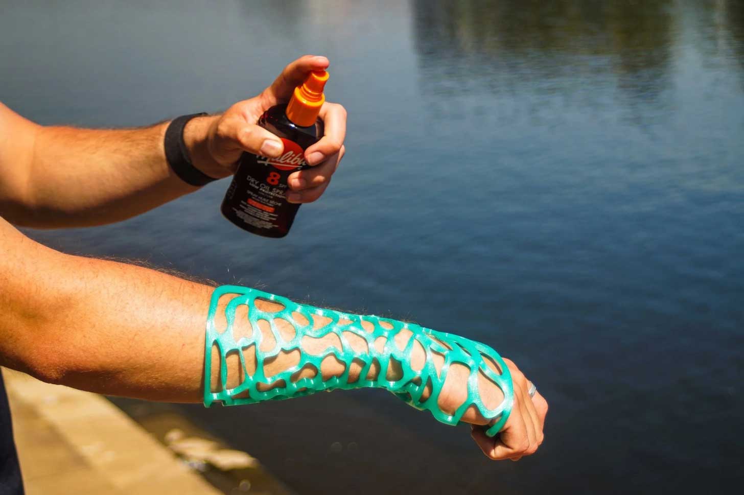 A green webbed-looking cast over an arm, person is spraying sunscreen on it