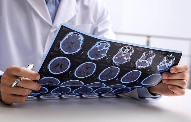 Stock image of a doctor looking at black-and-white scans of a brain