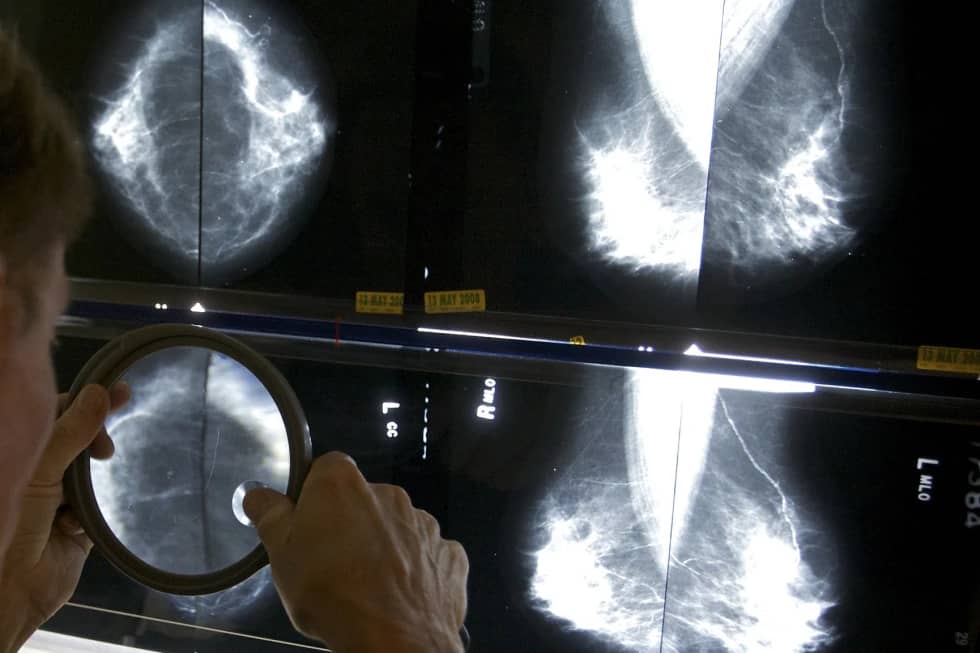 A doctor looking at x-ray scans