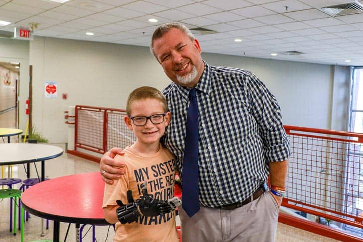 Scott Johnson and Jackson Farmer with his new prosthetic hand