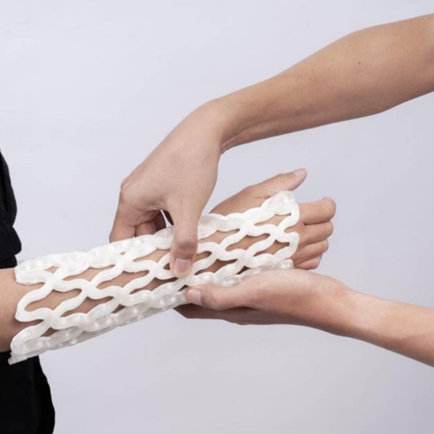 A white net-like cast around an arm