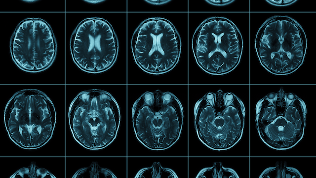 The Intersection of Faith and Neuroscience