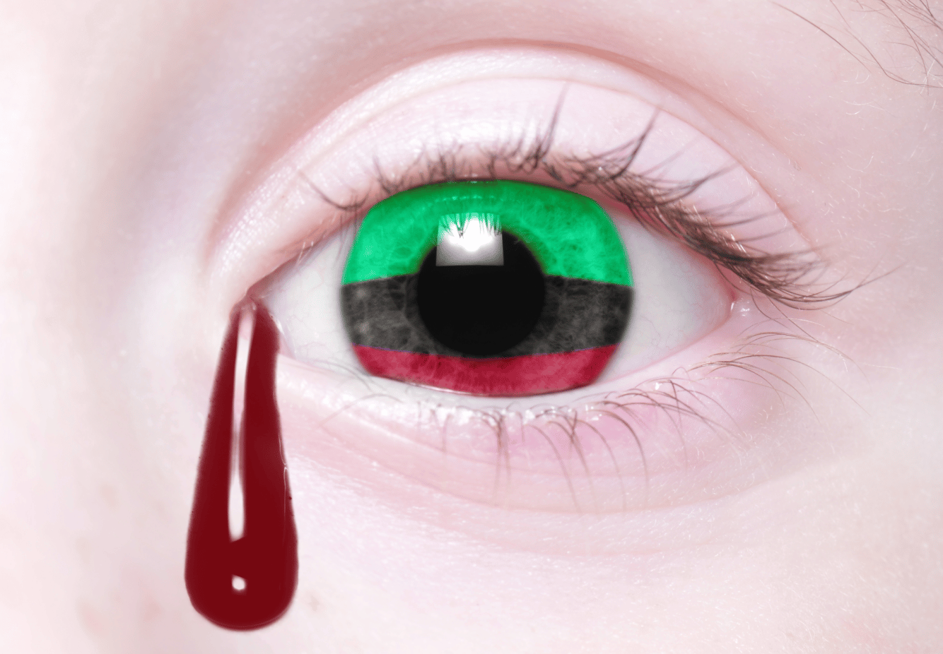 thumbnail placeholder