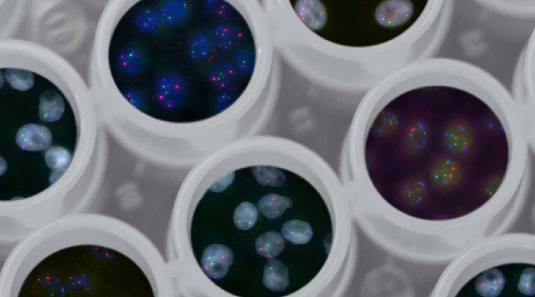 research petri dishes map out your customer dna